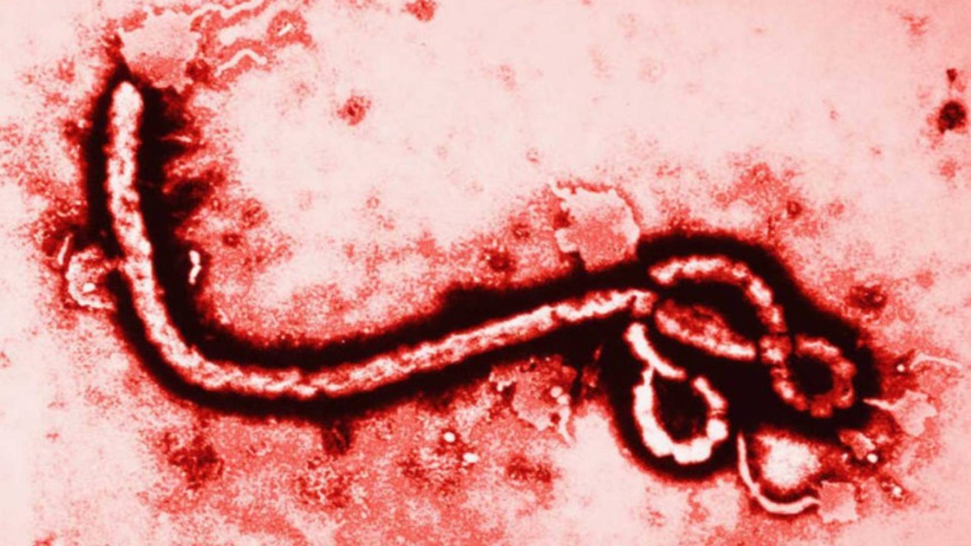 México descarta casos de ébola y activa protocolos sanitarios