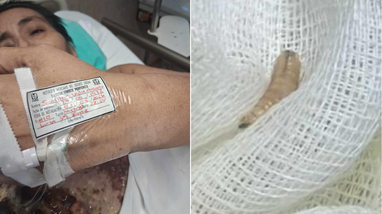 Alertan por presunto caso de gusano barrenador en IMSS Reynosa