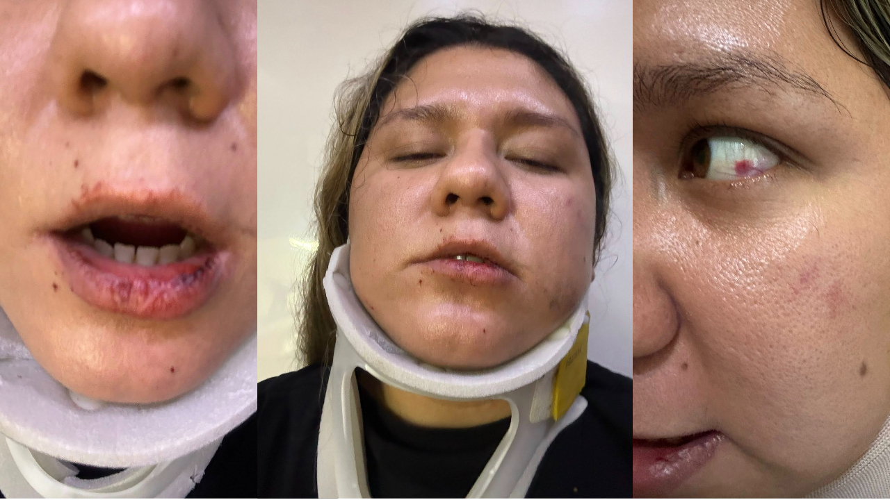 Mujer denuncia presunta agresión y amenazas de muerte por parte de su padre